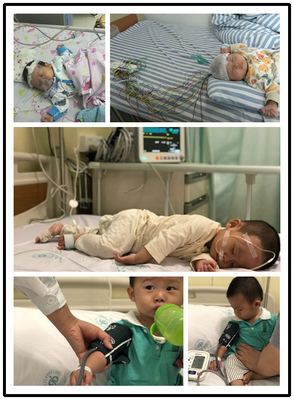 OEM&ODM Medical factory of Compatible Nellcor Oximax OXI-A/N Pediatric finger clip spo2 sensor